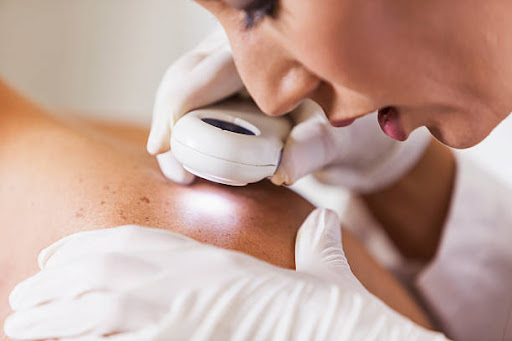 Discover Your Path to Skin Care Expertise: Studying Dermatology in Turkey (2024)